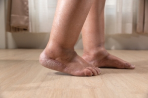 What Swollen Feet and Ankles Could Be Telling You